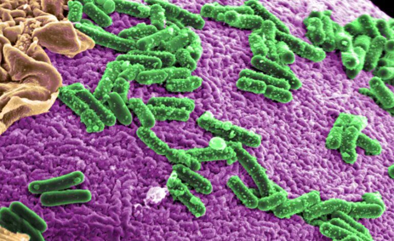 La relación entre bacterias intestinales y la enfermedad podría estar sobreestimada