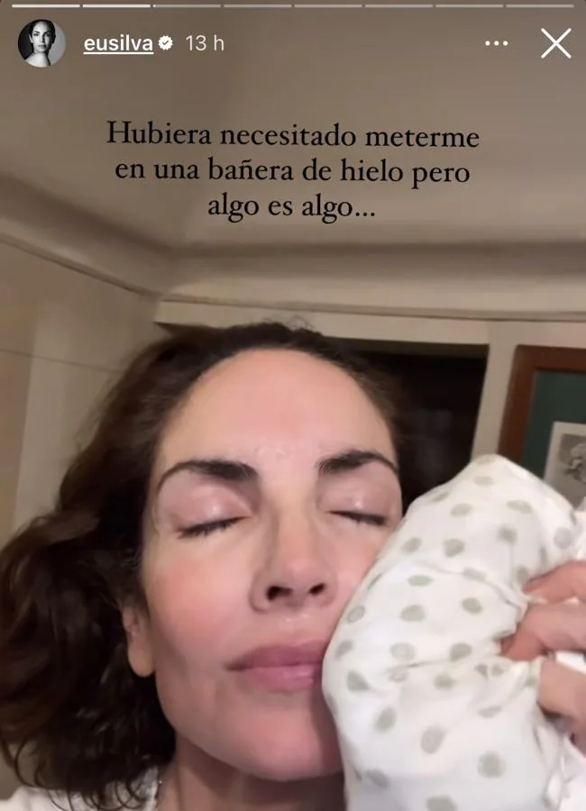 Eugenia Silva aplicándose hielo en la cara. @eusilva.