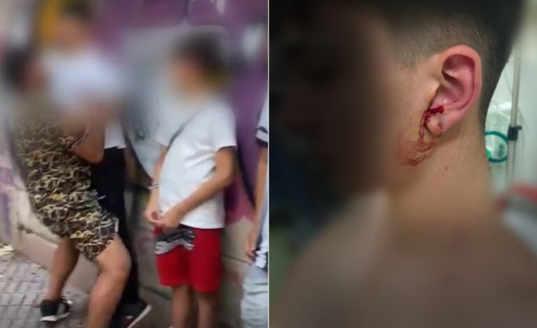 Salvaje agresión a varios menores en Vigo: «Papá, me van a matar»