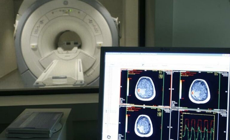 Qué es el meningioma, el tumor que crece sin apenas síntomas