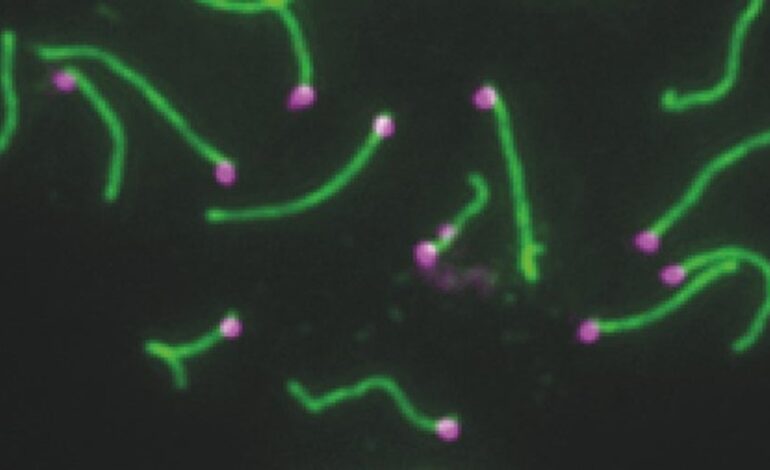 Descubren el papel de los genes del cromosoma Y en la fertilidad masculina