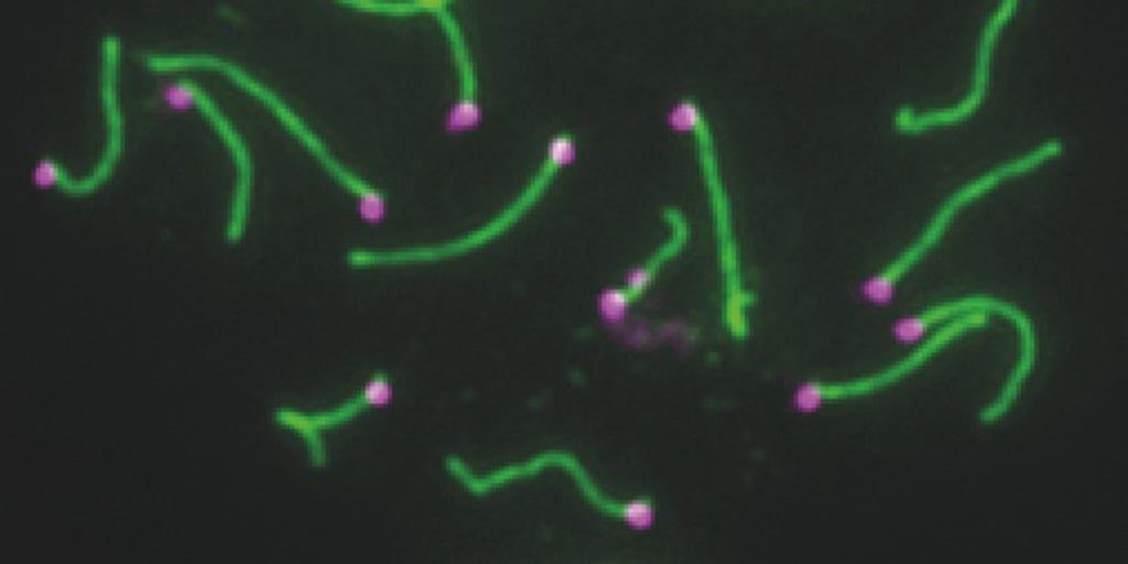 Descubren el papel de los genes del cromosoma Y en la fertilidad masculina