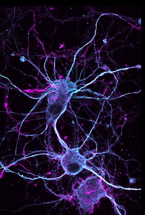 En un estudio publicado en Nature Chemistry, los investigadores de la UC Davis informan el éxito de la síntesis total de ibogaína, análogos de ibogaína y compuestos relacionados de piridina, una sustancia química relativamente barata y ampliamente disponible. Aquí vemos una neurona tratada con el análogo de ibogaína (-)-10-fluoroibogamina, que mostró efectos excepcionales sobre el crecimiento y la conexión neuronal. Andy Domokos/UC Davis