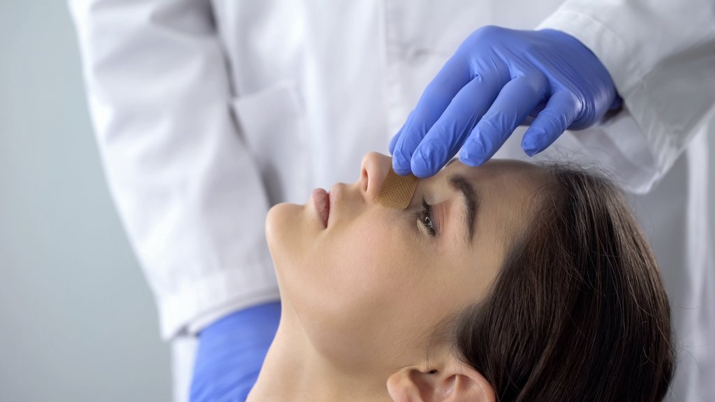 Médico examinando a su paciente después de la cirugía nasal - Imagen: Istock