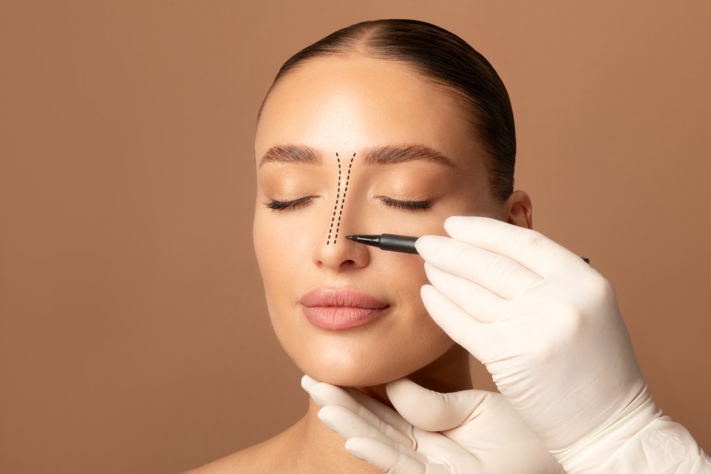 Rinoplastia - Imagen: Istock