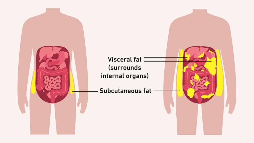 La grasa que está directamente debajo de la piel es menos problemática que la grasa visceral, que se encuentra en las profundidades de la cavidad abdominal.