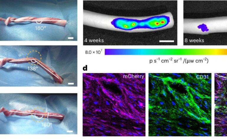 Penes en 3D, la apuesta para tratar la disfunción eréctil