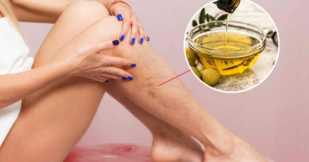 un aceite esencial que disimula las venas hinchadas y retorcidas y optimiza la circulación de forma natural