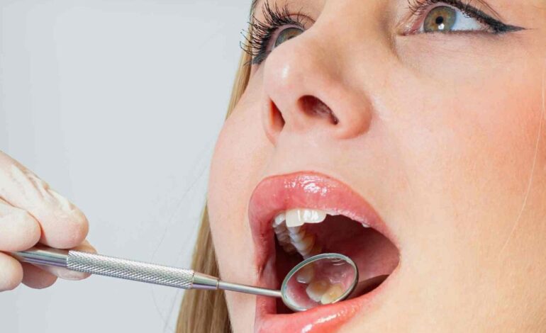 El hábito casero que las odontólogas avalan para eliminar el sarro de los dientes antes de la próxima selfie