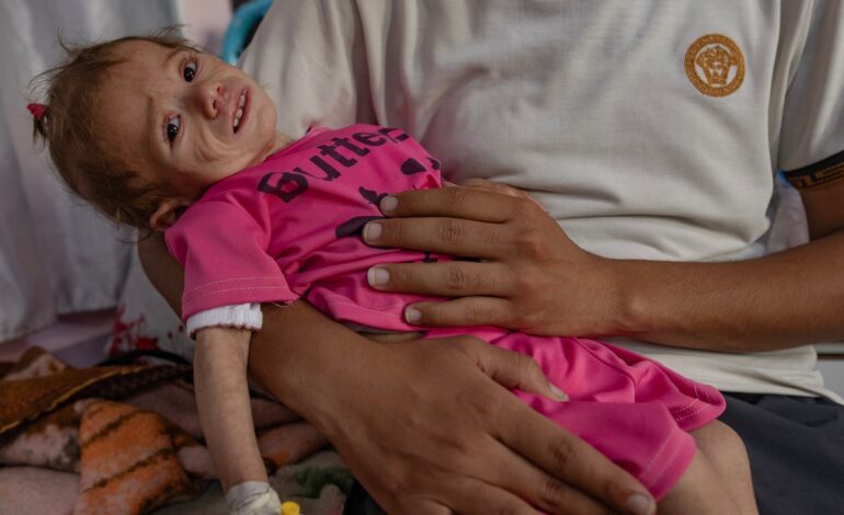 Los niños de cinco años no quieren vivir. Se preguntan por qué no murieron con su familia