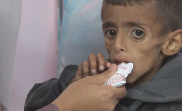 Los niños y niñas de la Franja de Gaza se mueren de hambre tras más de 60 días de bloqueo humanitario de Israel