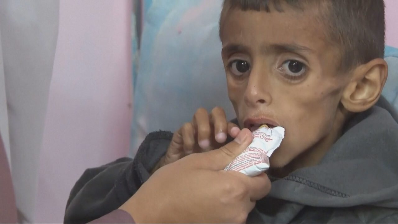 Los niños y niñas de la Franja de Gaza se mueren de hambre tras más de 60 días de bloqueo humanitario de Israel