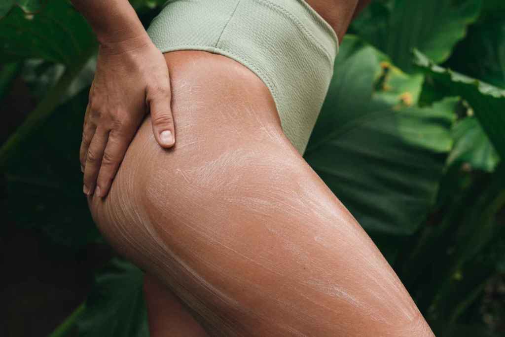 Las estrías no deben estar expuestas al sol sin protección