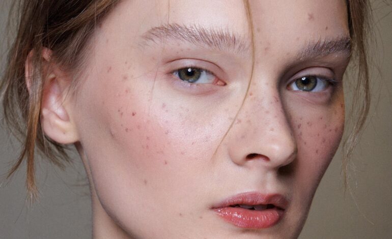 Mi truco para elevar todos mis maquillajes de verano son las pecas: guía para que queden naturales