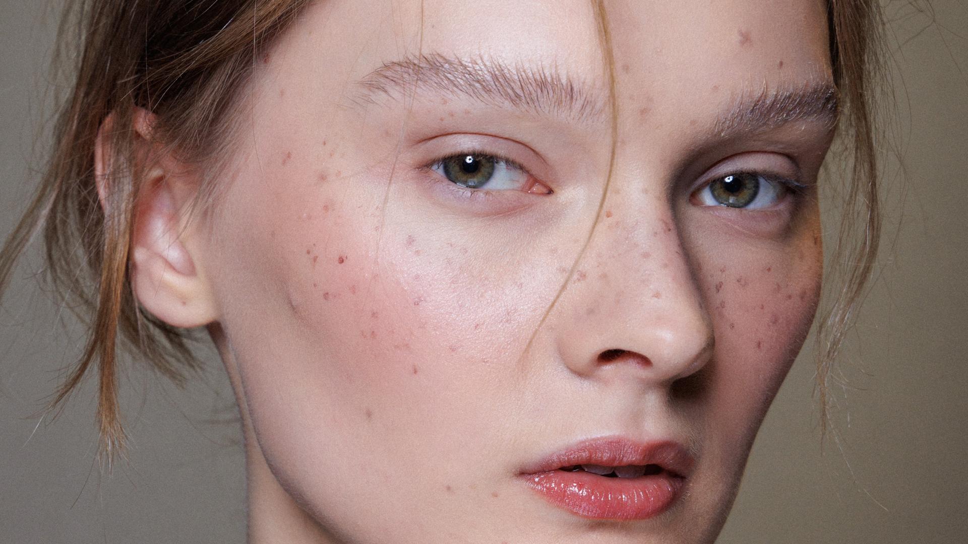 Mi truco para elevar todos mis maquillajes de verano son las pecas: guía para que queden naturales