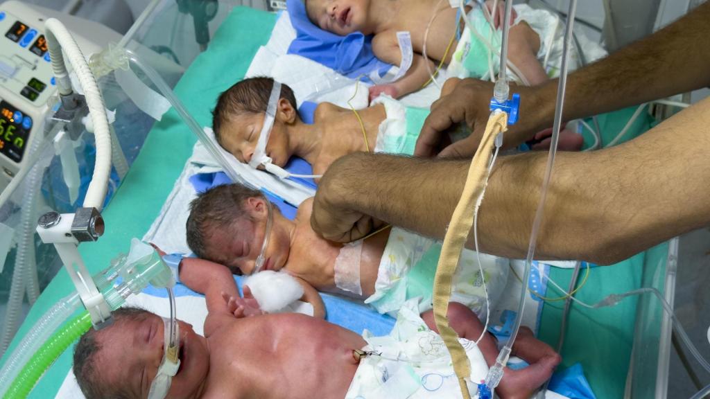 Fotografía del 17 de julio que muestra cuatro niños prematuros y con signos de desnutrición, en una sola incubadora en el Hospital de Helou en Gaza.