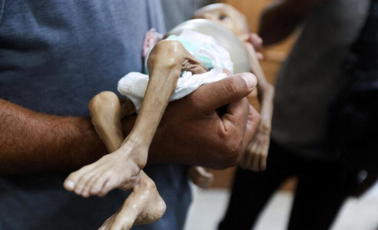 Israel permitirá la entrada de ayuda humanitaria en Gaza después de la muerte de 124 palestinos por desnutrición