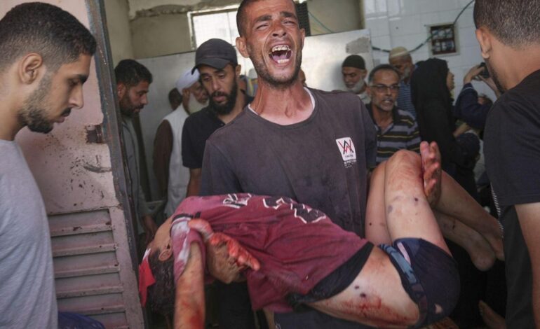 La ONU denuncia que una decena de niños pierden una o las dos piernas en Gaza cada día