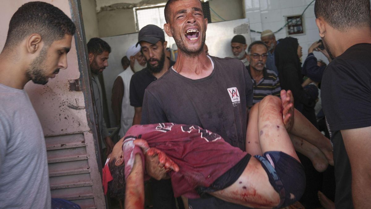 La ONU denuncia que una decena de niños pierden una o las dos piernas en Gaza cada día