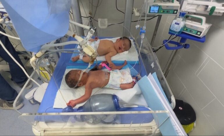580 niños prematuros están en riesgo de muerte por malnutrición