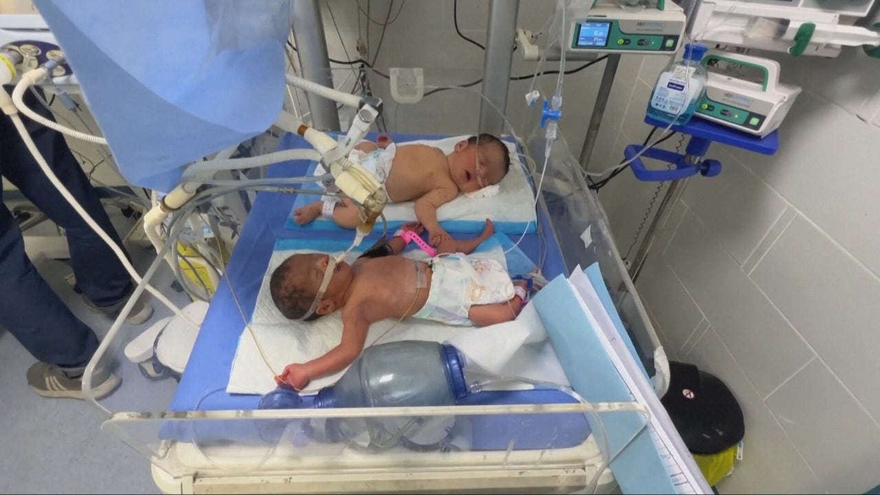 580 niños prematuros están en riesgo de muerte por malnutrición
