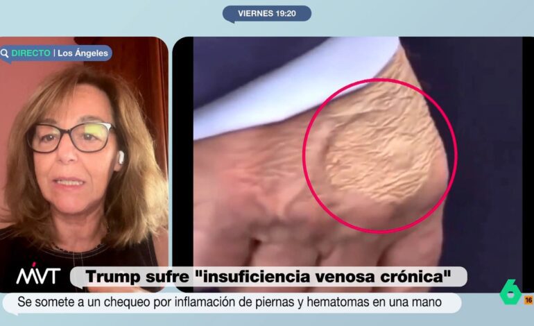Él tiende a disimular las cosas y decirte algo que no es cierto