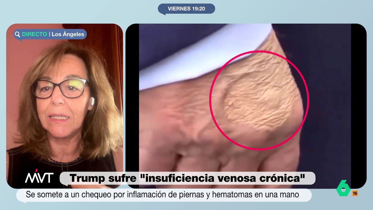 Él tiende a disimular las cosas y decirte algo que no es cierto
