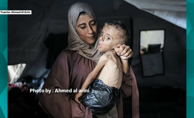 Mohammed, el niño de un año que pesa como uno de tres meses y cuyo rostro muestra el horror en Gaza