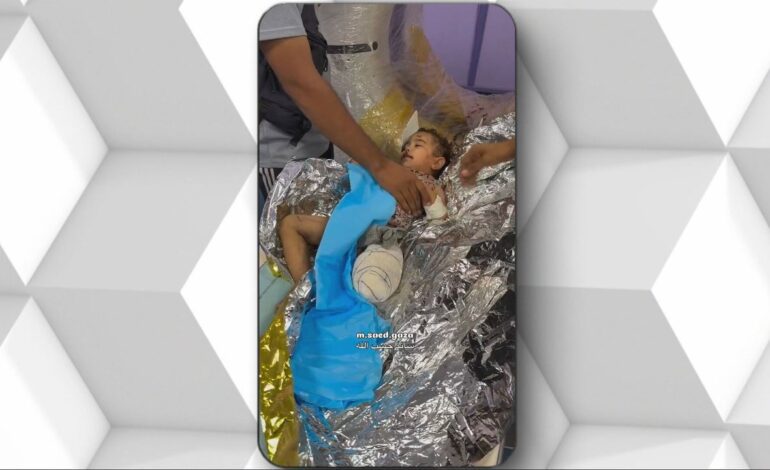 Zeina, de 18 meses, es una de ellos