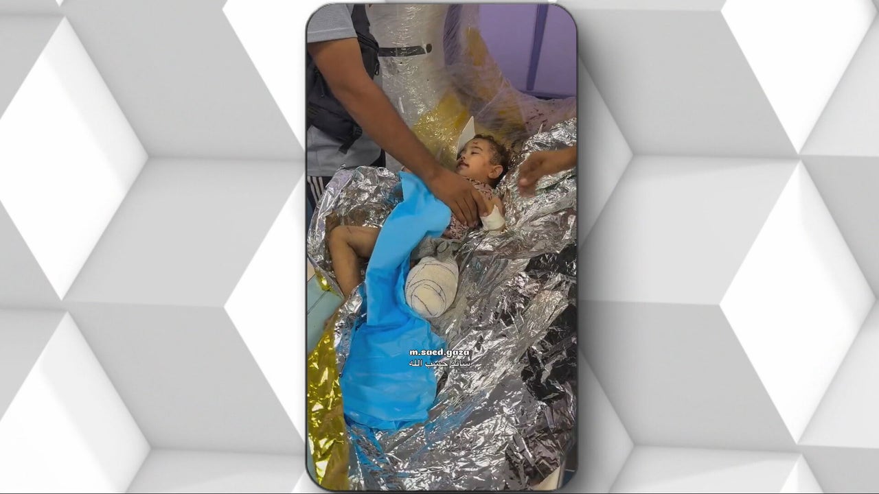 Zeina, de 18 meses, es una de ellos