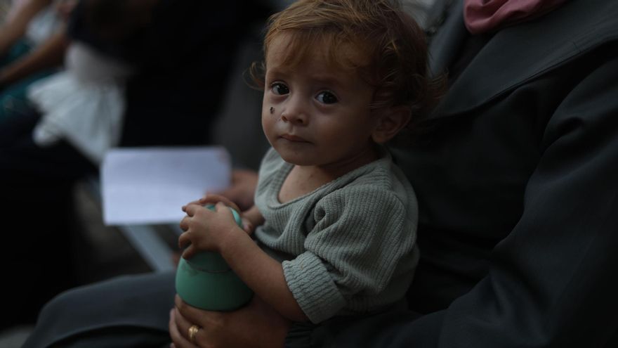 HAMBRE GAZA | Esperanza Santos, MSF: «Los niños malnutridos tienen los ojos hundidos y la mirada perdida, les cuesta sonreír»