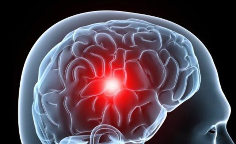 Estos son los 5 síntomas de alerta del ictus y así puedes prevenirlo