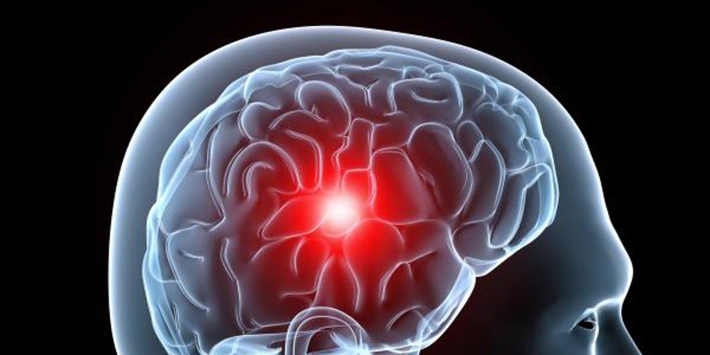 Estos son los 5 síntomas de alerta del ictus y así puedes prevenirlo