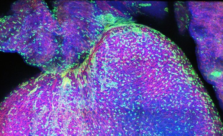 Este mapa explica cómo es corazón humano durante el desarrollo prenatal