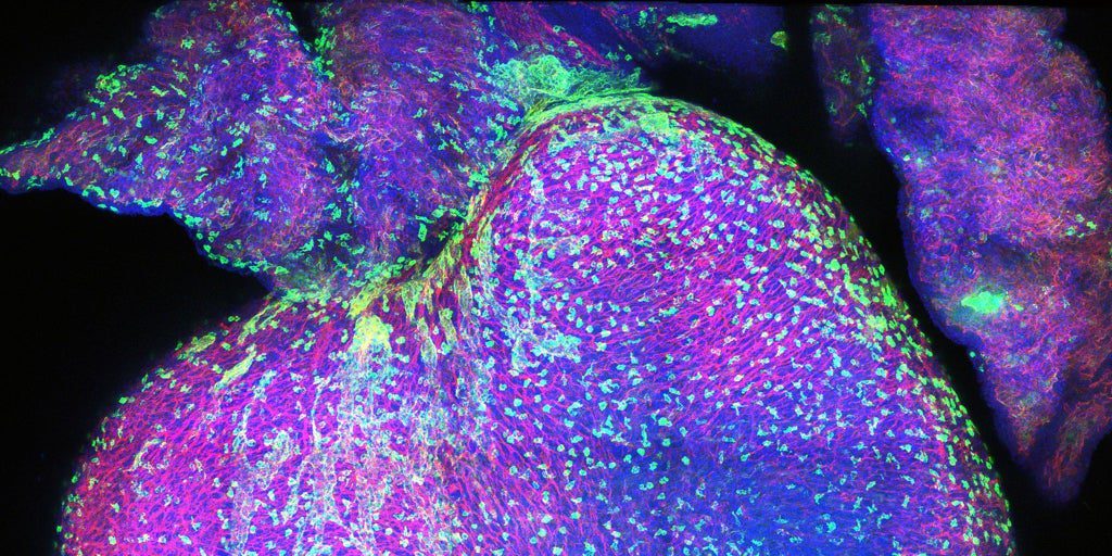 Este mapa explica cómo es corazón humano durante el desarrollo prenatal