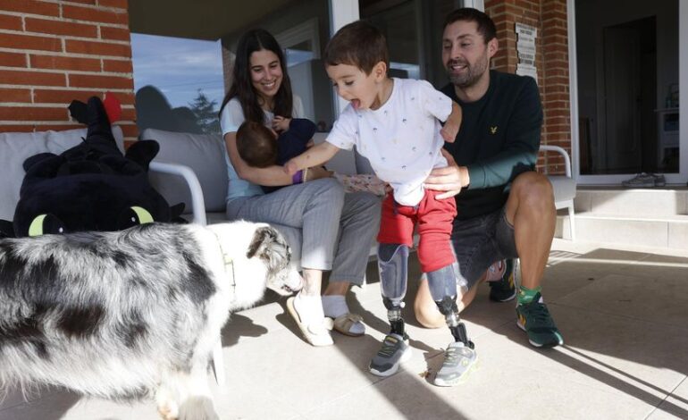 Mael Aldecoa, el pequeño gijonés que perdió las extremidades por una infección vuelve a caminar con unas "piernas de robot"