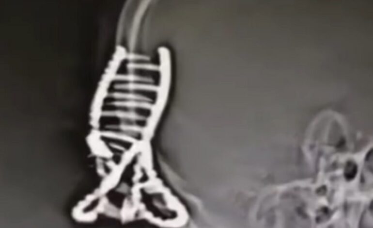 así quedó esta chica después de usarlo al conducir