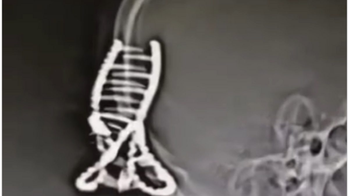 así quedó esta chica después de usarlo al conducir