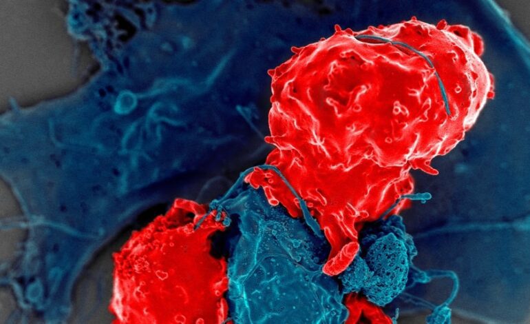 La inmunoterapia CAR-T llega a la forma más común de enfermedad cardíaca