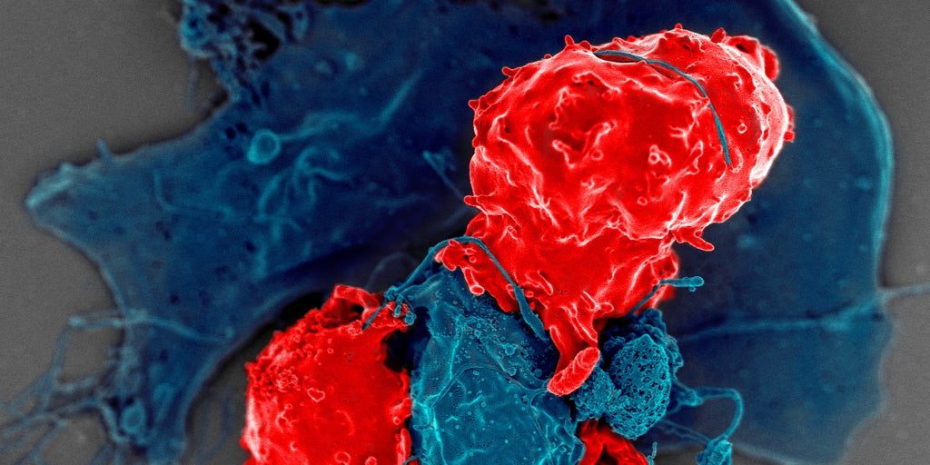 La inmunoterapia CAR-T llega a la forma más común de enfermedad cardíaca