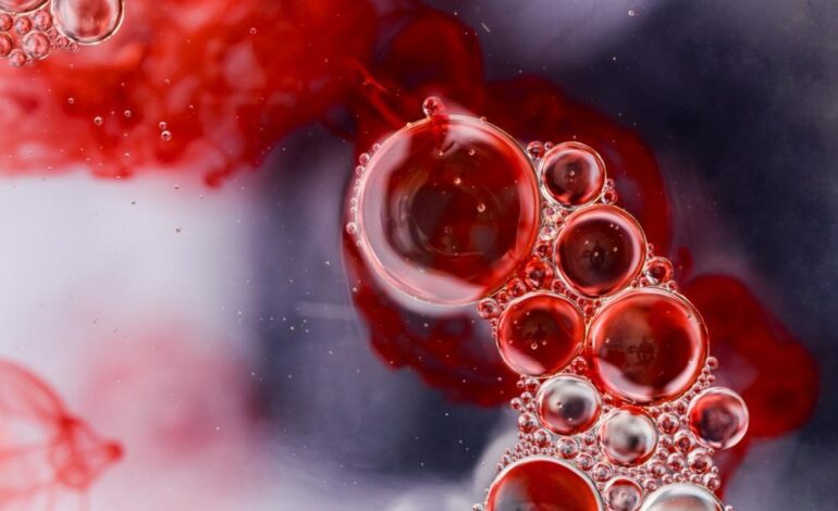 ¿Tiene controlado el colesterol? reducir riesgos es fácil, pero pocos lo hacen