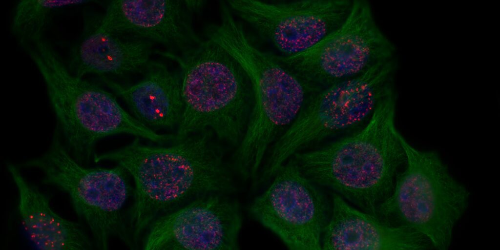 Eliminar las células ‘viejas’ revierte la inflamación y mejora la diabetes