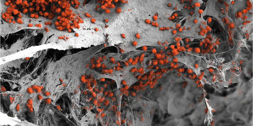 Fabrican un modelo de médula ósea completo a partir de células humanas