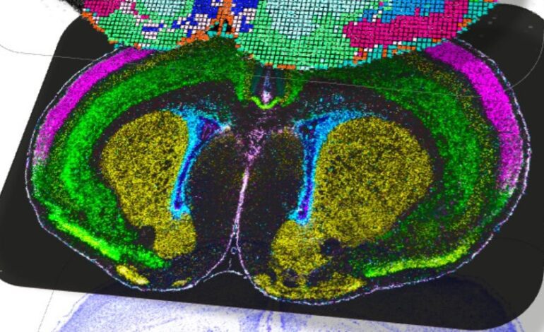 El atlas más detallado del cerebro revela cuándo y cómo surgen enfermedades como el autismo o la esquizofrenia