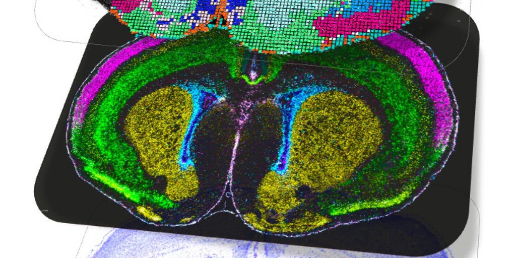 El atlas más detallado del cerebro revela cuándo y cómo surgen enfermedades como el autismo o la esquizofrenia