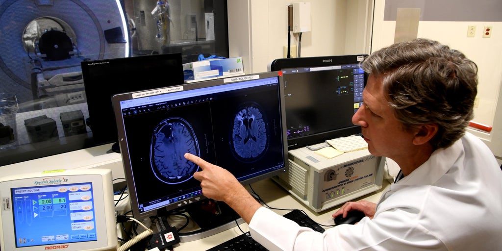 Una terapia de ultrasonidos mejora la supervivencia en un agresivo cáncer cerebral