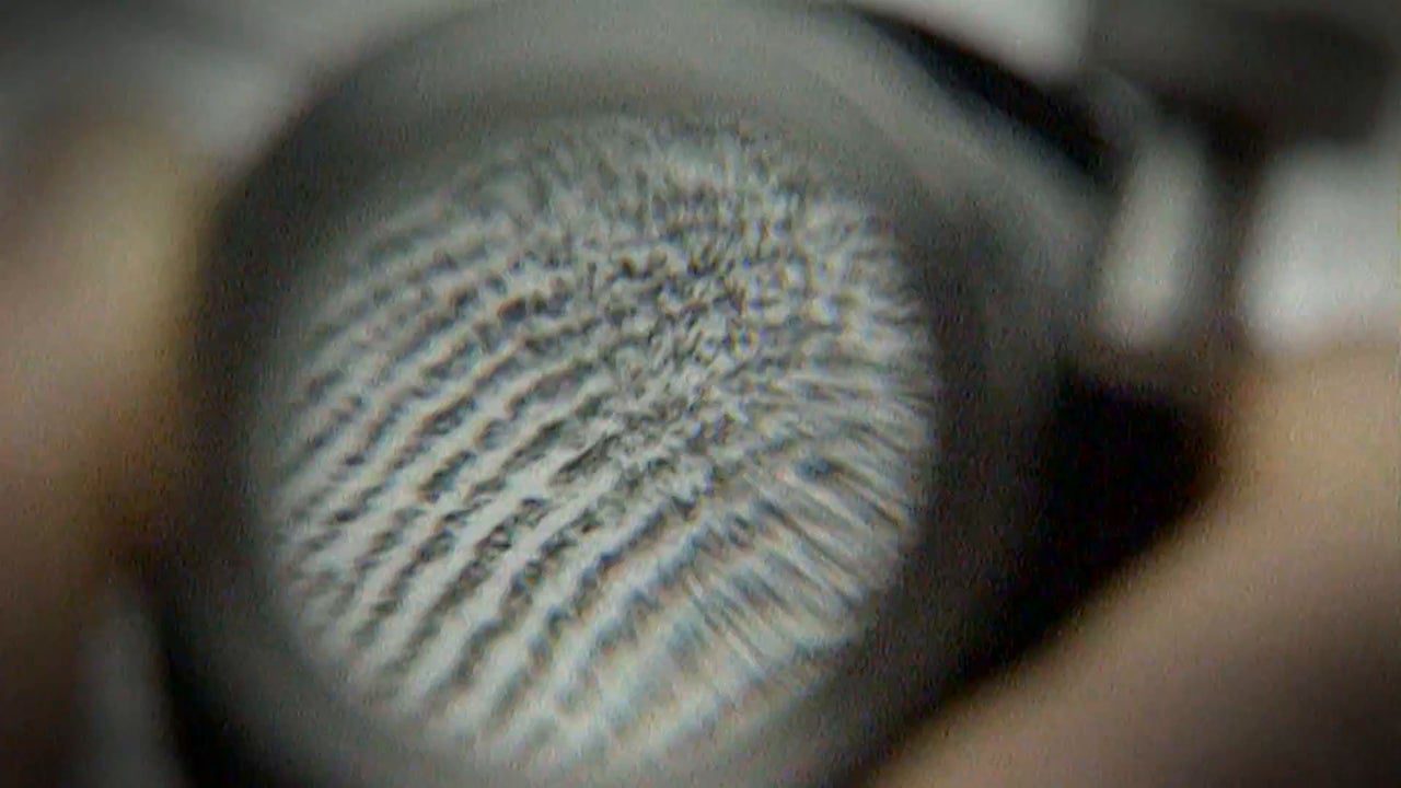 así permite el ADN poner rostro a crímenes sin resolver