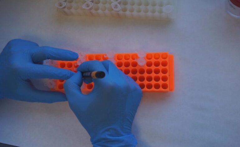 Un análisis de sangre abre la puerta a detectar el Alzheimer antes de los primeros síntomas