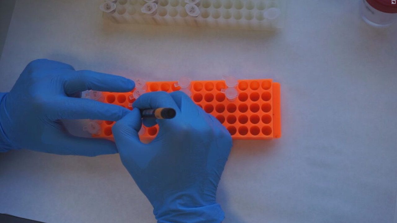 Un análisis de sangre abre la puerta a detectar el Alzheimer antes de los primeros síntomas