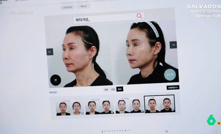 Lo que más piden es mandíbula en forma de flor, piel impecable…